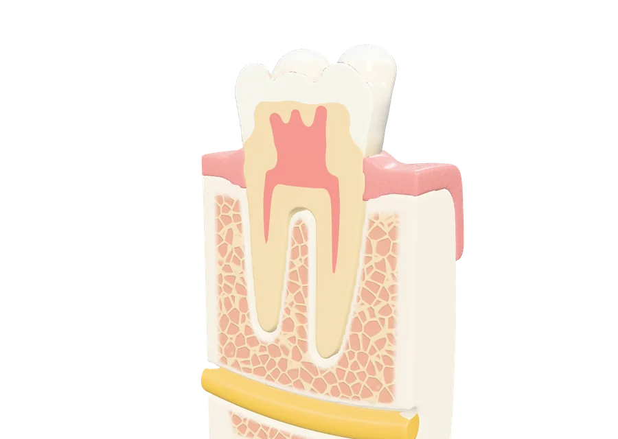 Lower molar in the jaw bone, in section: enamel, dentine, the pulp with its canals and the inferior alveolar nerve